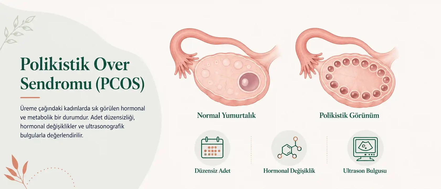 PCOS Nedir? Polikistik Over Sendromu Belirtileri ve Hormonal Süreçler — kapak görseli